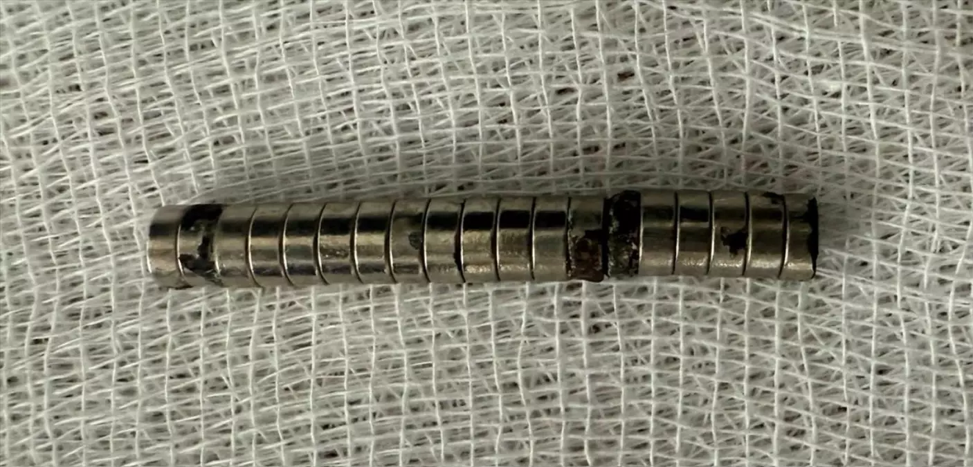 elazigda miknatis yutan cocuk kurtarildi Q5Ia9Nzr